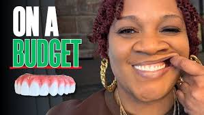 Dental Implant Overdentures Facebook Live Video