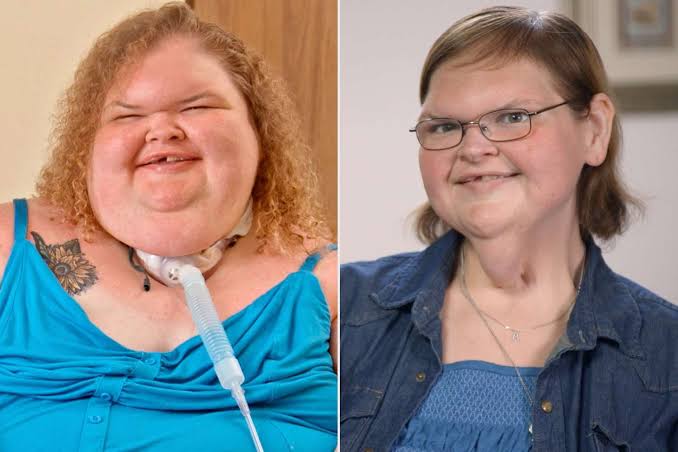 Inside Tammy Slaton's Weight Loss Journey: See Her Before and After Losing  500 Lbs.