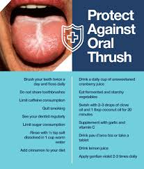 Image result for oral thrush symptoms roof of the mouth