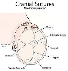 Die große fontanelle braucht etwa zwei jahre, um sich vollständig zu schließen. Craniosynostosis Symptome Ursachen Und Behandlung Thpanorama Heute Besser Werden