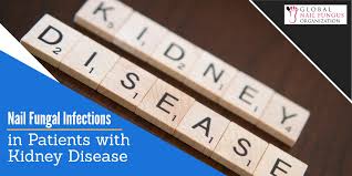 The recent classification includes following. Nail Fungal Infection In Patients With Chronic Kidney Disease Gnfo