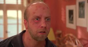 Have you ever had a whitehead