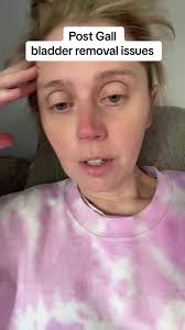 Does anyone else out there that’s gotten the gallbladder removed deal with  the same issues? If so, what kind of treatment options were given to you to  help deal with it? How do you officially got ...