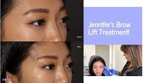 With eyebrow threading, perfect brows are just a twist and a pull away. Bella Hadid Brow Lift Pdo Thread Lift Youtube
