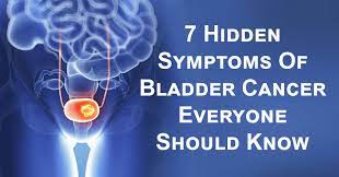 Possible causes, signs and symptoms, standard treatment options and means of care and support. 7 Hidden Symptoms Of Bladder Cancer Everyone Should Know David Avocado Wolfe