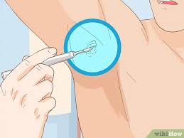 How do you trigger that? 4 Simple Ways To Get Rid Of Boil Scars Wikihow