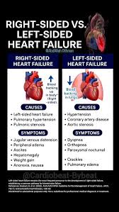 Image result for Right Heart Failure