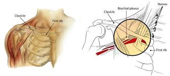 We did not find results for: Burners And Stingers Orthoinfo Aaos