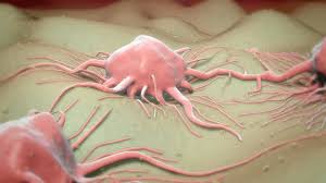 Check spelling or type a new query. Cancer Cell Tumor Metastasis Computer Animation Hd Stock Video 263 741 269 Framepool Stock Footage