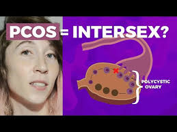 Is PCOS intersex?