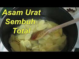 Asam Urat Rematik Sembuh Total Hanya Dengan Ramuan Alami Ini Youtube Asam Urat Youtube Penyembuhan