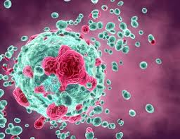Cancer is the uncontrolled development of cells. Do You Know What The 5 Most Common Types Of Cancer Are