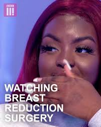 This is what can happen if a breast reduction goes wrong. (BBC Three)