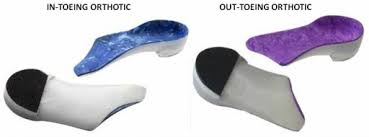 Image result for Out-toeing