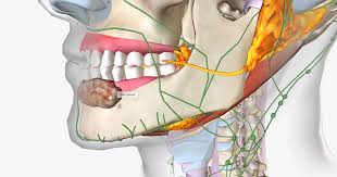 Image result for dental cancer