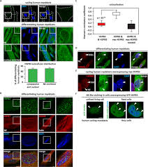 Pixel experience for mi 3 and mi4 cancro /* * your warranty is now void. Small Heat Shock Protein Hspb3 Promotes Myogenesis By Regulating The Lamin B Receptor Cell Death Disease