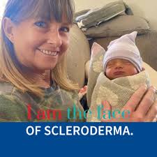 What to do when sourdough starter is not rising after feeding?