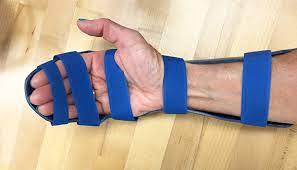 This exercise can be done daily. Dorsal Blocking Orthosis For Flexor Tendon Rehabilitation