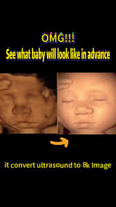 Ultrasound Tech Ai Doll