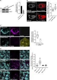 La bloc a fost unul dintre cele mai indragite si mai longevive seriale romanesti. Mitochondrial Aurora Kinase A Induces Mitophagy By Interacting With Map1lc3 And Prohibitin 2 Life Science Alliance
