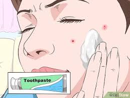 Most people experience some kind of skin reaction after being bitten by a mosquito. 4 Ways To Stop Mosquito Bites From Itching Wikihow
