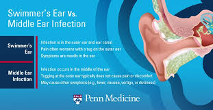 If your ear becomes inflamed or swollen, you may have developed an ear infection. Swimmer S Ear 10 Things You Need To Know Penn Medicine