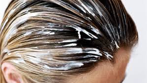 Interdiction formelle de laisser pousser ses cheveux quand la calvitie devient sérieuse! Traiter L Alopecie Traitements Medicaux De L Alopecie Doctissimo