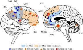 But pmdd also causes severe anxiety, depression and mood changes. Neuroimaging Premenstrual Dysphoric Disorder A Systematic And Critical Review Sciencedirect