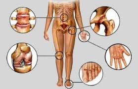 Take care of your joints now to prevent joint pain later. Discover 7 Ways To Reduce Joint Pain And Arthritis Fitneass
