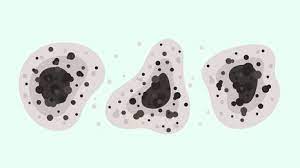 En realidad no se llama 'hongo negro' su nombre es mucormicosis, pero como la piel suele necrosarse esta no es una enfermedad nueva, lo que pasa es que la cantidad de casos presentados rebasa los datos históricos, desde 1940 hasta el 2003 hubo menos de 1.000 casos en todo el mundo. Hwmfeg09pacz5m