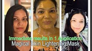 Black And White Bleaching Cream Results Pin On Home Re