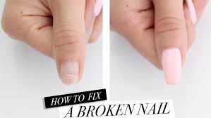 Your damaged nail needs to grow out completely so that it can be replaced with a healthy nail. Nail Repairs And What Are Nail Repair Costs Associated With Them