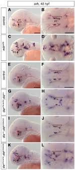 Written by baker thatter monday, 2 august 2021 add comment. Deltaa Deltad Regulate Multiple And Temporally Distinct Phases Of Notch Signaling During Dopaminergic Neurogenesis In Zebrafish Journal Of Neuroscience