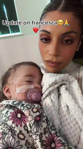 Francesca Swollen Feet