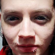 Pigmentación ocular o eyeball tattoo, o tatuaje ocular, en opinión personal  la primera es la correcta, gracias por la asistencia @maxiiiucveraa  #eyeballtattoo #eyetattoo #tatuajeocular #pigmentacionocular  #modificacioncorporal #bodymodification ...