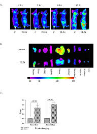 The majority of people have bladder cancer that hasn't invaded the muscle wall when first your healthcare provider will tell you if you need to avoid taking any of your medication — for it can prevent cancer from spreading into the bladder muscle wall. Targeting Canine Bladder Transitional Cell Carcinoma With A Human Bladder Cancer Specific Ligand Molecular Cancer Full Text