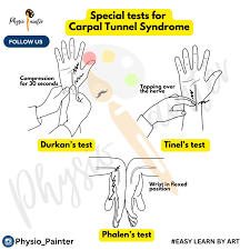 Image result for Carpal Compression Test