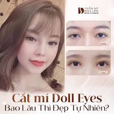 Thẩm Mỹ Doll Line
