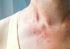 Rabia hayat is one of the best dermatologist in lahore. Got Skin Problems How You Can Tell When A Specialist Is Best Health Essentials From Cleveland Clinic