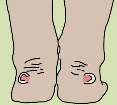 как избавиться от волос в зоне бикини народными средствами Ona Poderzhala Nogi V Opolaskivatele Dlya Rta 30 Minut To Chto Sluchilos Potom Napominaet Chudo Zdorove Ot Prirody Zdorove I Krasota Varikoz