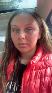 So I did a thing 💋 #fyp#foryou#lipfillercheck#lipfillers#goviral#trending