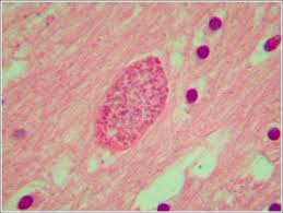 Image result for Balantoides Coli