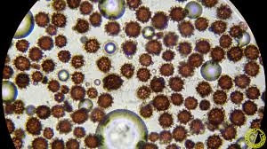 Image result for Scleroderma polyrhizon