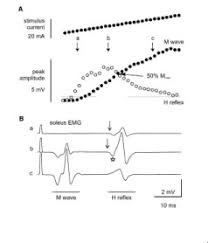 Monitoring of patients in the intensive care unit making sense of your patient's vital. The H Reflex Of Soleus A The Top Trace Shows The Steady Increase In Download Scientific Diagram