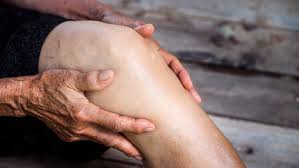 Arthrose An Hufte Oder Knie Op Vermeidbar Ndr De Ratgeber Gesundheit