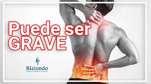 Check spelling or type a new query. Rectificacion Cervical Debe Corregirse