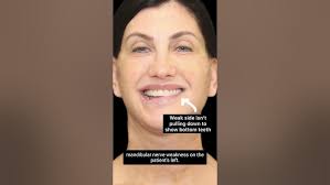 Congenital Facial Paralysis with Dr Bryn Webb