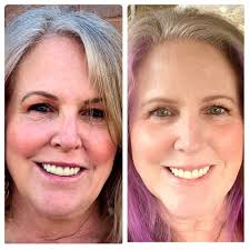 TOP 10 BEST Acne Facial in Flagstaff, AZ