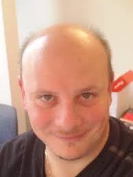 Michaël WINCKLER (C.H.U. de Reims)