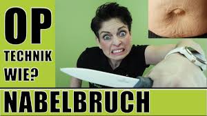 Ihre befürchtung, dass eine vorstellung beim chirurgen wahrscheinlich zur operation führt, ist durchaus berechtigt. Wie Wird Ein Nabelbruch Operiert 5 Umbilikalhernie Nach Schwangerschaft Operation Op Maike Droste Youtube